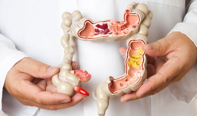 肠胃系列（中篇）结直肠癌