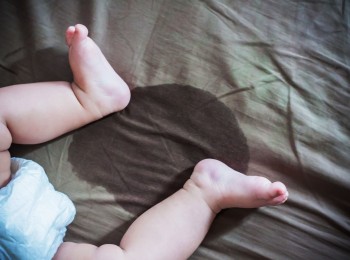 【医生专稿】给新手父母的话：何时需要儿科泌尿外科？