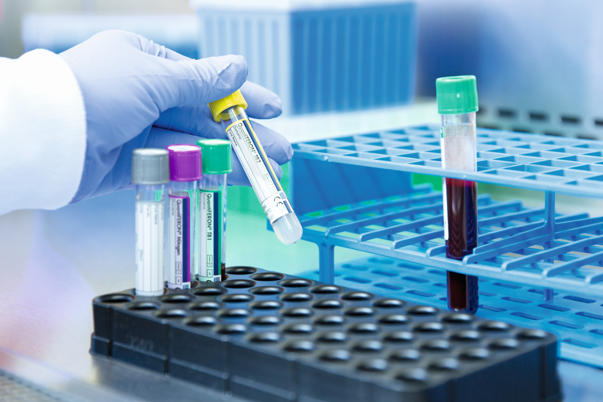 【资讯】凯杰IGRA提升泰国筛查效益