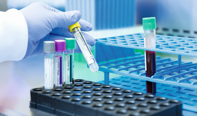 【资讯】凯杰IGRA提升泰国筛查效益